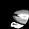SPORK, NICO - 22.03.1976 - 02.08.2022 - CT obere Extremität - 17:51:17